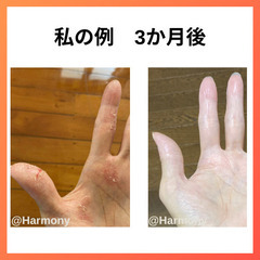 たった3ヶ月でガサガサー肌→別人級うるツヤ肌になった秘策を伝授します✨の画像