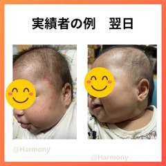 たった3ヶ月でガサガサー肌→別人級うるツヤ肌になった秘策を伝授します✨の画像