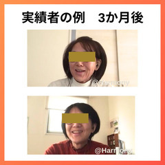 たった3ヶ月でガサガサー肌→別人級うるツヤ肌になった秘策を伝授します✨の画像