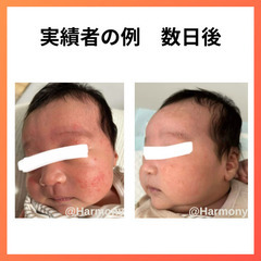 たった3ヶ月でガサガサー肌→別人級うるツヤ肌になった秘策を伝授します✨の画像