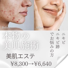 肌質改善・ニキビでお悩みの方