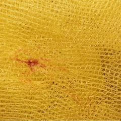 ゴミネットの画像