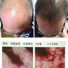 水素吸入サロン＊肩こり・疲れが気になる方に