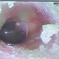 セラピスト（イヤーセラピスト）大募集の画像