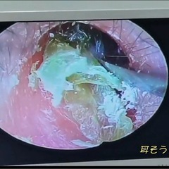 セラピスト（イヤーセラピスト）大募集の画像