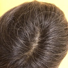 ⬛︎アデランス男女兼用トップピース⬛︎ の画像