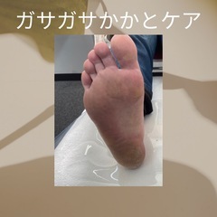 ガサガサかかとケア👣⸒⸒3000円‼️