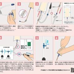 NUTRI 加圧バッグ II （胃ろう注入用、未開封）の画像