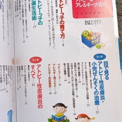 赤ちゃん・子どもの アトピー&アレルギー大百科の画像