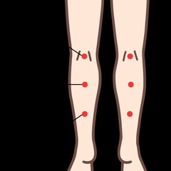 【足つぼ資格】足裏から体を読み取れる技術を学ぶ3時間講座｜実技あり・アフターフォローつきの画像