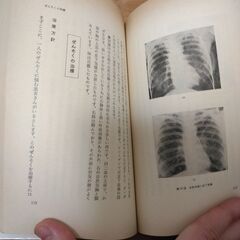 『アレルギーのはなし』渡辺勝之延　同文書院の画像