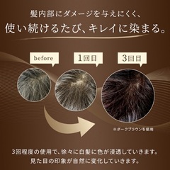 アンファー スカルプD ボーテ 白髪染め ヘアカラートリートメント ブラック 手袋付の画像