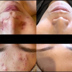 【南堀江5名様限定】毛穴洗浄を受けてみたい方へ✨お肌ケアのご案内（男女OK）の画像