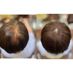 【人毛100%トップピースを期間限定！特別価格にてお譲りします】の画像