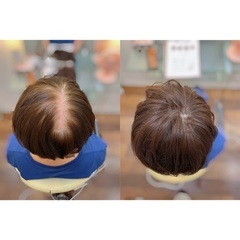 【人毛100%トップピースを数量限定！特別価格にてお譲りします】の画像