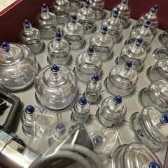 カッピング 吸玉の画像