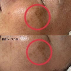 【50代女性の本気！！】ハーブの底力で美肌へ