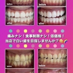本日のみの受付‼️ホワイトニング施術🦷✨2年間通い放題🔥今後販売はありません！※販売期間あり⚠️購入希望の方は本日12/8中にお問い合わせ下さいの画像