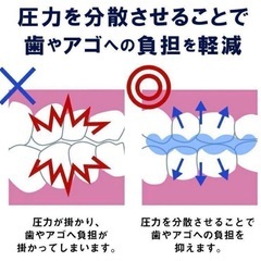 睡眠グッズ 繰り返し使用可能 マウスピース おとなしくん 歯ぎしり 食いしばりの画像