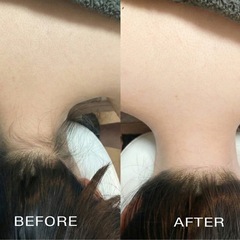 夏に向けて今から‼️光フェイシャル、脱毛の画像