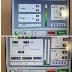 ライエンス2 業務用脱毛機 エステ ネイルサロン 美容院 IPL 光脱毛  脱毛器の画像