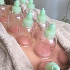 【１DAY講座】リラクゼーションカッピングセラピスト講座の画像