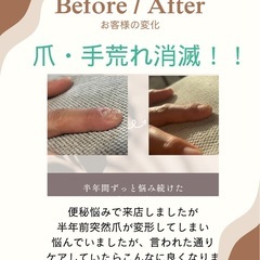 【ジモティー限定】腸もみモニター募集の画像