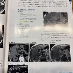 肝胆膵の画像診断　改定第2版の画像