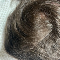 部分カツラの画像