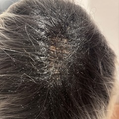 プリン風金髪ウィッグの画像