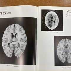 定価15000円　CT SCAN 診断のための脳解剖図譜　の画像