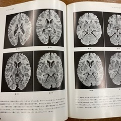 定価15000円　CT SCAN 診断のための脳解剖図譜　の画像