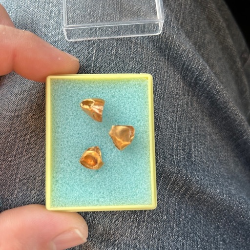 金歯 被せ物