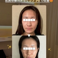 【30〜40代女性】スキンケアを頑張っても肌が変わらない方へ｜無料カウンセリングの画像