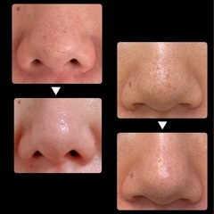 【30〜40代女性】スキンケアを頑張っても肌が変わらない方へ｜無料カウンセリングの画像