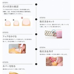 巻き爪ブロック　フルセット　ノーマルの画像