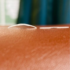 巻爪矯正プレートのビフォーアフター