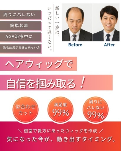 半額メンズウィッグ／トップピース｜プロ美容師が似合わせカットまで対応』