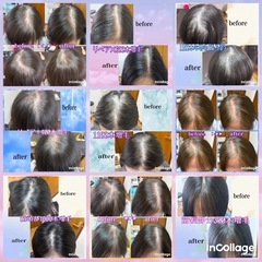 薄毛の悩み解消！増毛エクステ初めての方割引きキャンペーンの…