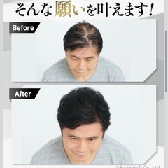 チャップアップモアシーラの画像