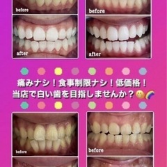 ペア割👭ホワイトニング20回×2人 39,000円🔥1組限定の画像