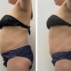 お腹痩せモニター🔥たるんだお腹恥ずかしくないですか💦？3週間で本気のお腹痩せ🔥の画像