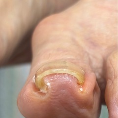 自爪ケア(爪のお手入れ)のお客様増えております❗️