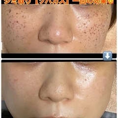 ノーファンデ、すっぴん肌なりたい方、10日結果出します🙋🏻…