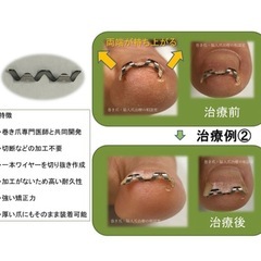 ネイルエイド の画像