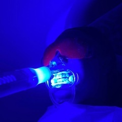 キャンセルが出たため再募集1名様🤲🏻表示金額から更に60%割引！！ セルフホワイトニング🦷半年間通い放題チケット(最低保証付き)3/25までの画像