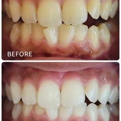 4/1(水)限定💦10回チケット＋6回メンテナンスチケット(12,500円)を無料で付けて25,000円😳の画像